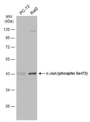 Western Blot: c-jun [p Ser73] Antibody [NBP3-13304]